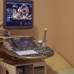 Orvosi ultrahang készülék fotó
