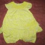 sárga fehér ruhácska napozóval Rovha little Rocha 0-3 hó fotó