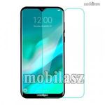 SUNSHINE Hydrogel TPU képernyővédő fólia - Ultra Clear, ÖNREGENERÁLÓ! - 1db - Doogee X90 - GYÁRI fotó