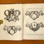1894 Dr. Mann Jakab - Szülészeti műtéttan / Bábakönyv fotó