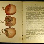 1897 DR. SCHAEFFER OSZKÁR : A SZÜLÉSZET ATLASZA ... 2 KÖTETBEN RITKASÁG ILLUSZTRÁLVA (BGX) fotó