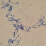 PZO biológiai mikroszkóp binokuláris (vér, gomba, vizimütyűrök, stb) fotó